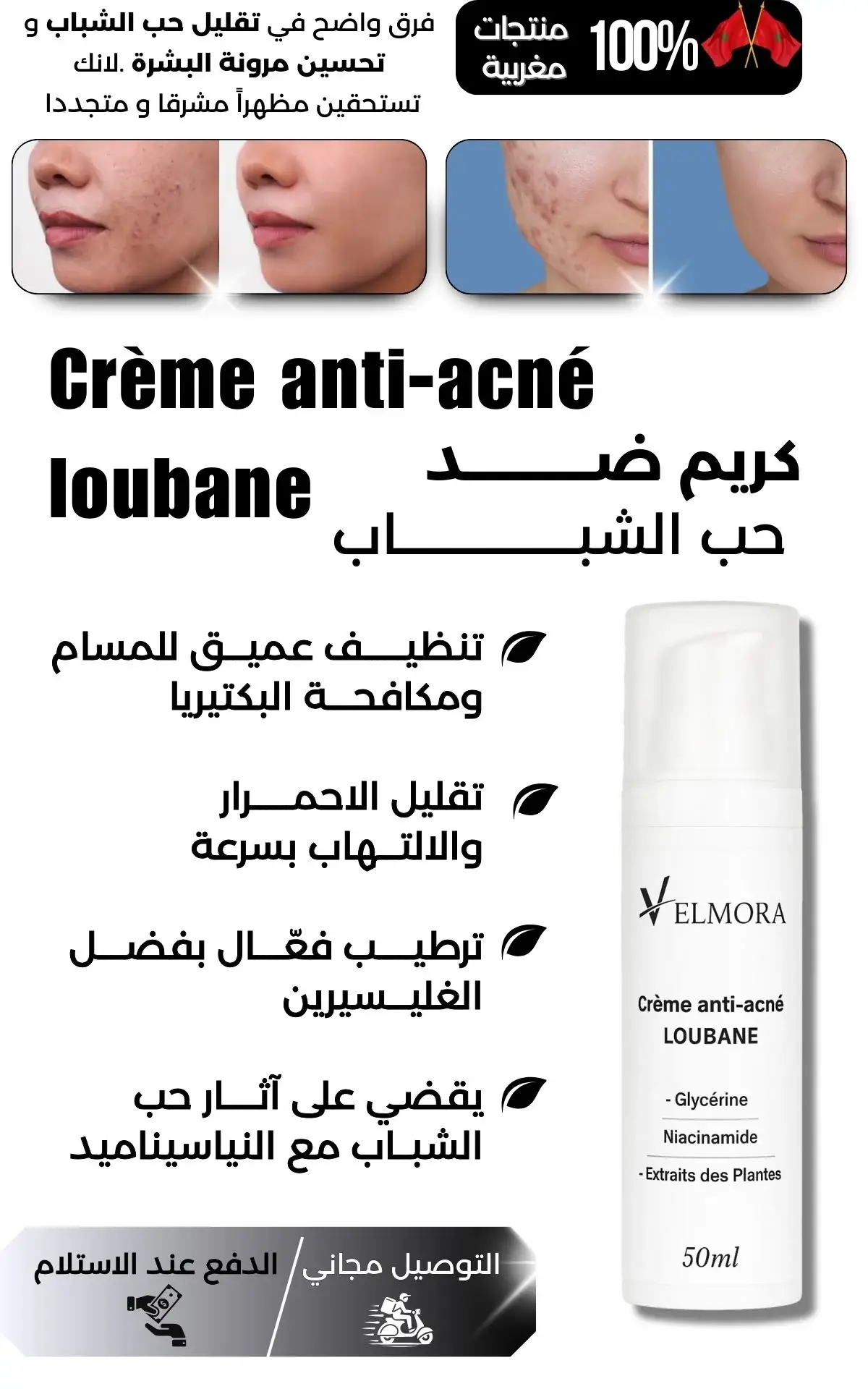 anti-cerne lobane 3 velmora products