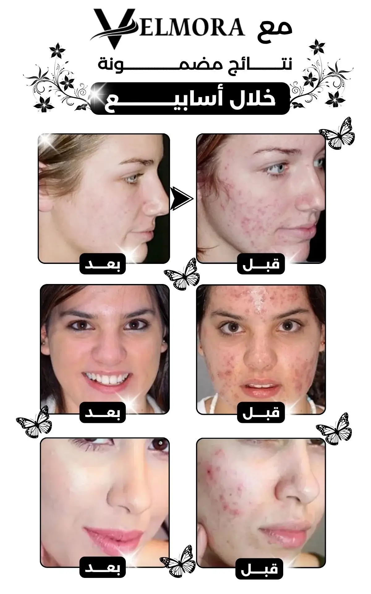 anti-cerne lobane 4velmora products