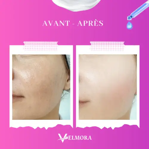 mousse nettoyante velmora lifestyle